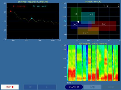 Onmon Voice mode2 SS